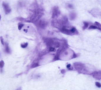 Brightfield photomicrograph of normal SNB motoneurons and pyknotic cells.